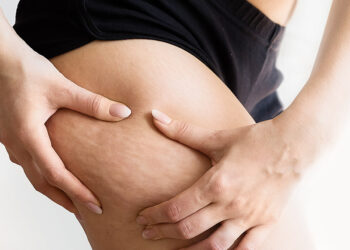 Bacak yağlanmasına dikkat!