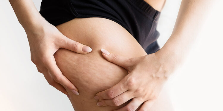 Bacak yağlanmasına dikkat!