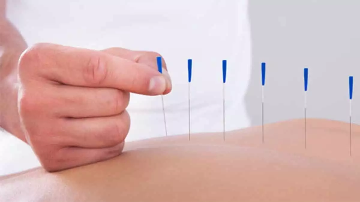 Hiperaktiviteye akupunktur tedavisi