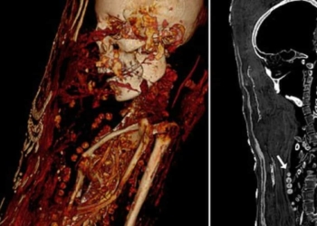 Mumyaların gizemi bilgisayarlı tomografide