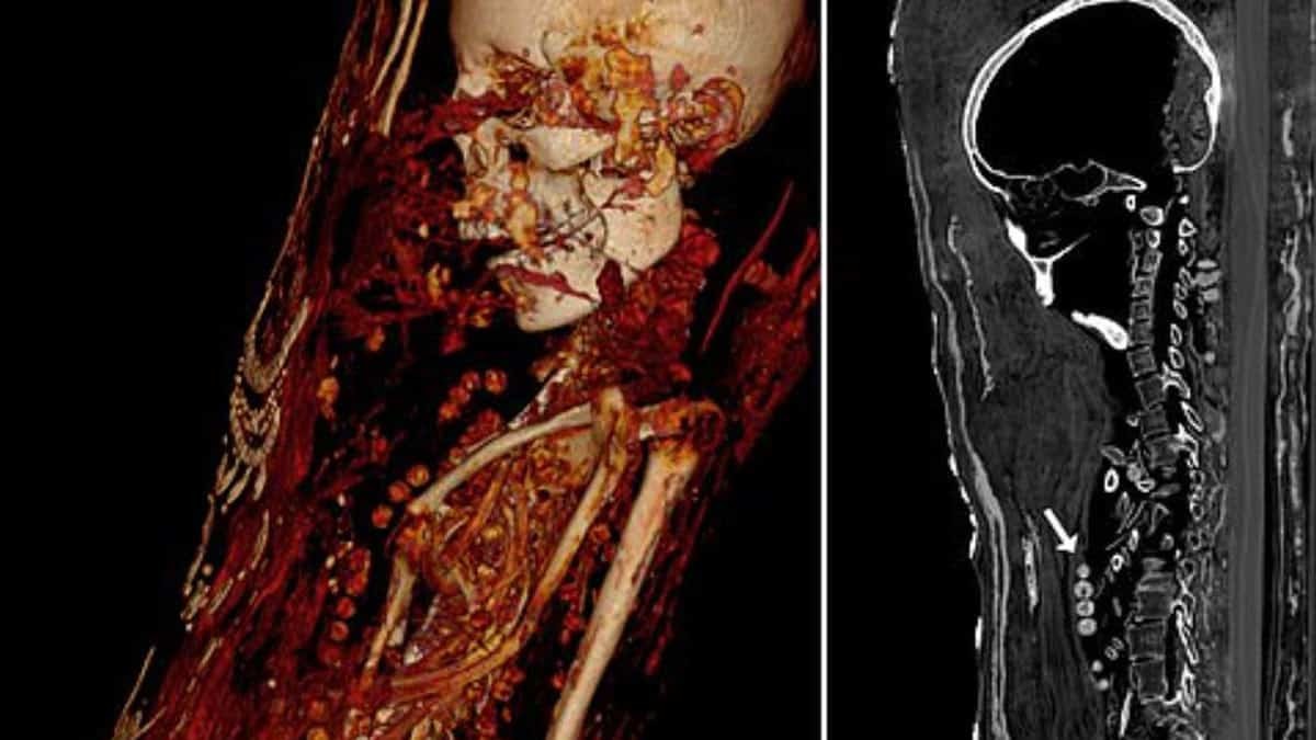 Mumyaların gizemi bilgisayarlı tomografide