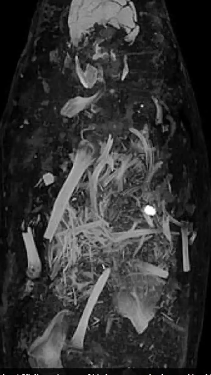 Mumyaların gizemi bilgisayarlı tomografide
