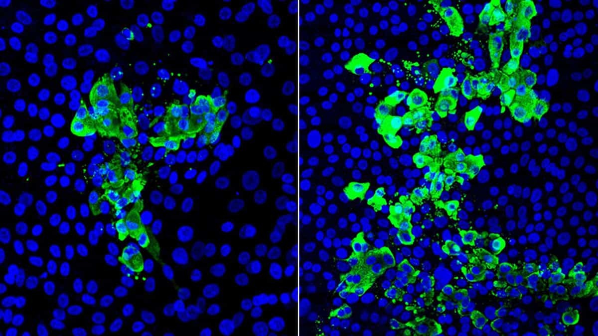 Sigara içmek 3 kat daha fazla etkiliyor