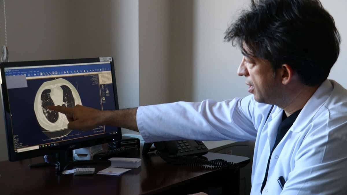 Covid-19, akciğerdeki solunum keseciklerinde hasara yol açıyor. Orada bir sertleşme, büzüşme, solunum keseciklerinin fonksiyonlarını yitirmesine neden oluyor.