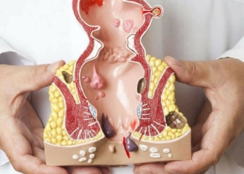 Hemoroid rahatsızlığında artış