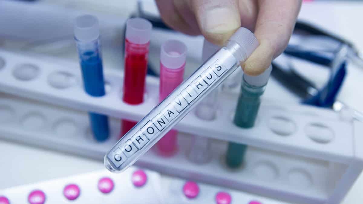 Vaka sayıları her gün yeni bir rekor kırıyor