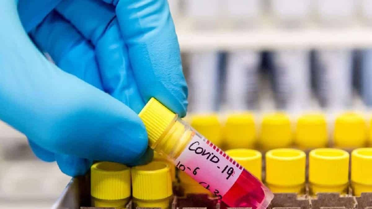 Rusya'da son 24 saatte 23 bin 675 vaka