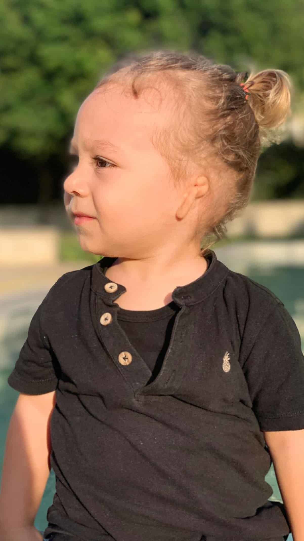 Sarp 'Kulak Yokluğu' (Microtia) hastası olarak dünyaya geldi. Sarp'ın annesi Yağmur Aktaş, Amerika'ya en kısa sürede gidebilmeyi umud ettiklerini "lütfen yardım çağrımıza Sarp'a kulak verin" diye konuştu.