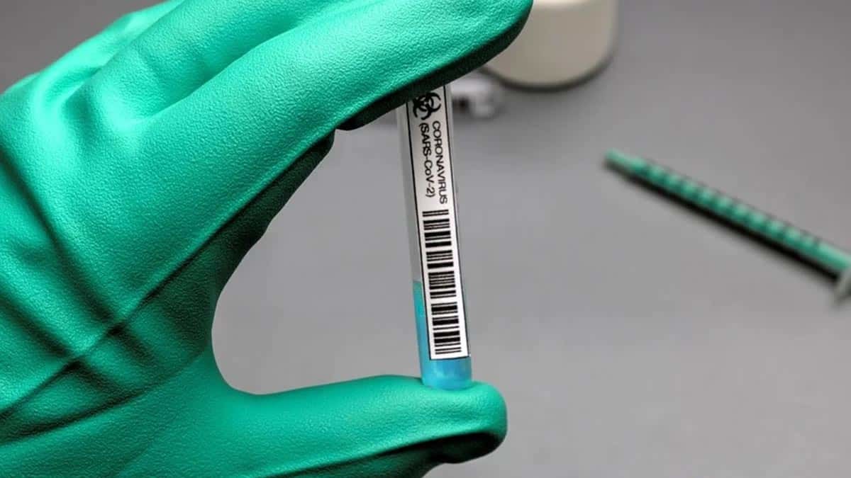 Bir doz koronavirüs aşısı 19.5 dolar