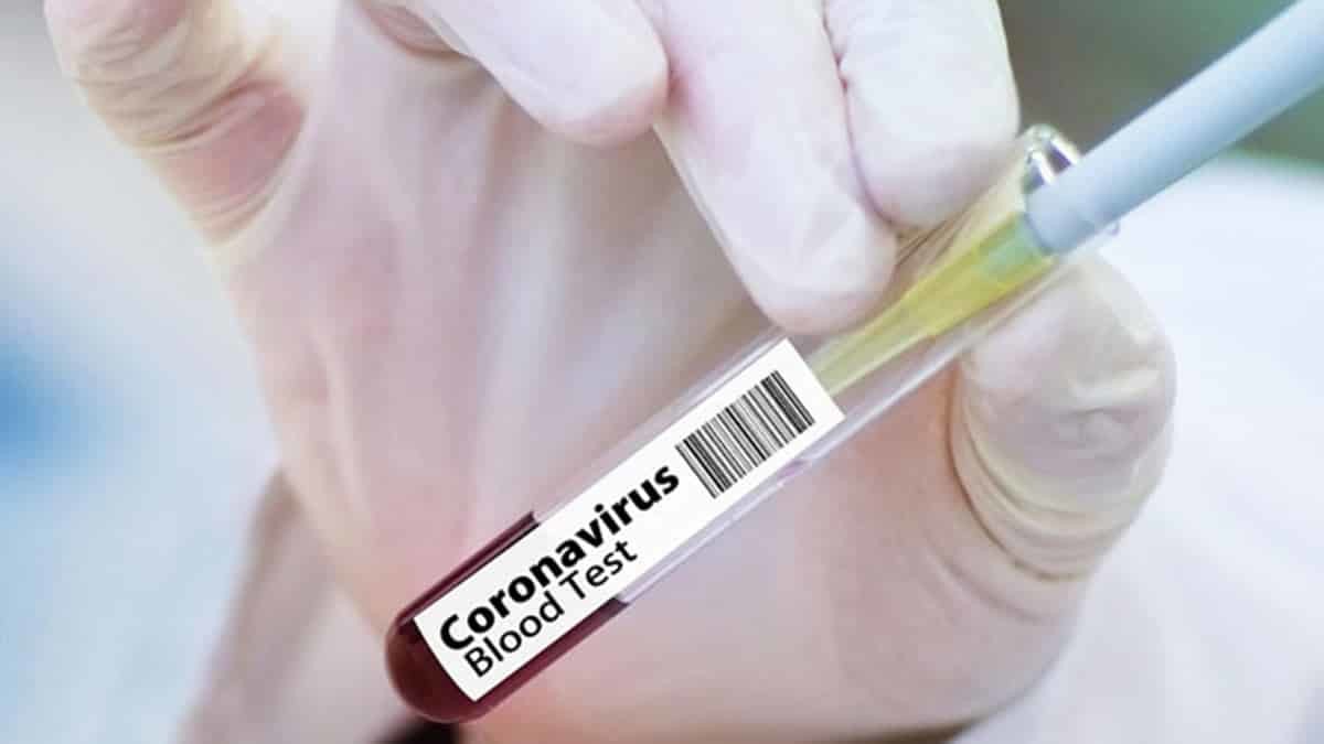 Covid-19'un sancıları sürüyor