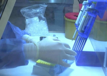 Uzmanlar evde yapılan hızlı testler konusunda uyarıyor, Tanı koymada güvenilir değil mutlaka hastaneye giderek PCR testi yaptırmalı.