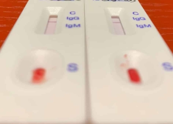 PCR testlerinin yalancı negatif sonuç verme ihtimali var