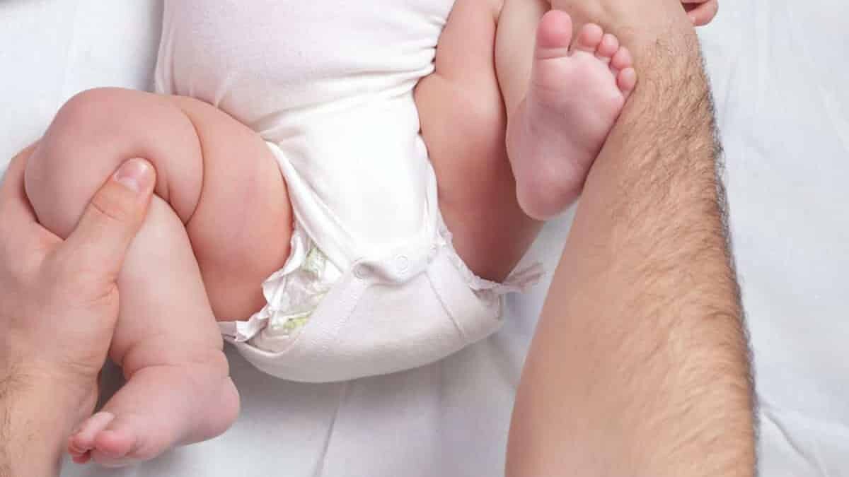 Kalça çıkığı tedavi edilmediğinde kıkırdakta yırtılma olur