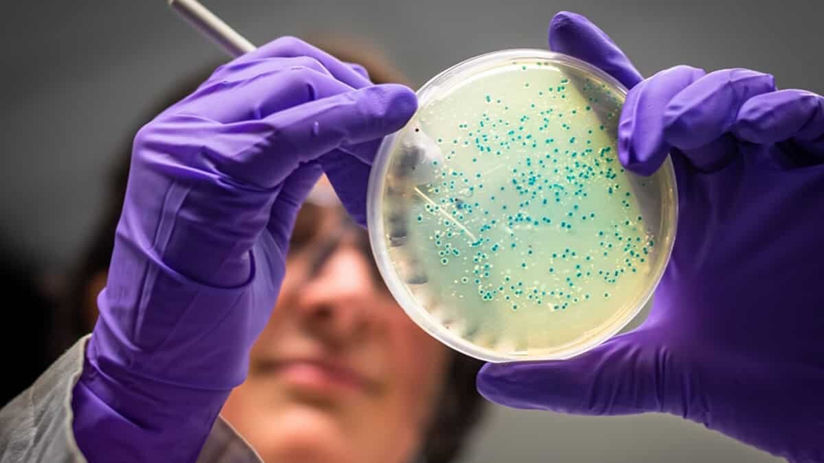 Hassas Bağırsak Sendromu tedavisinde yüzde 78 başarı