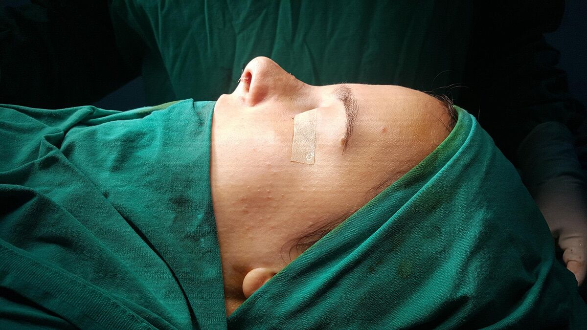 Virüs salgınına rağmen burun estetiğine ilgi arttı