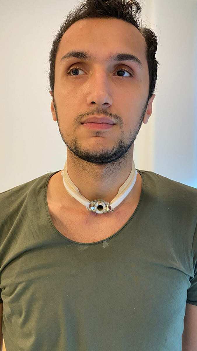 Yoğun bakımdan çıktıktan sonra, konuşmakta zorlanan, sesi dahi çıkmayan Kartal'a hekimler tarafından “bundan sonra sesin kısık kalacak” denildi ama Kartal aylar sonra konuştu.