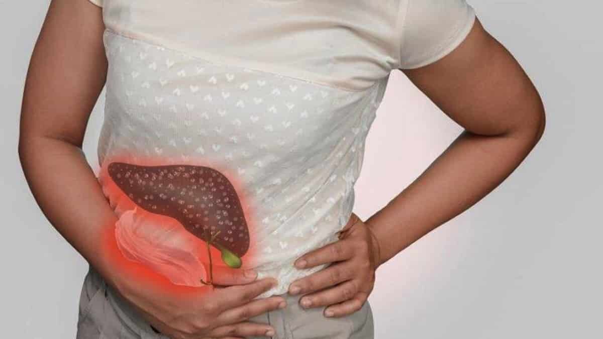 Siroz hastalığı koronavirüste ölümle sonuçlanıyor