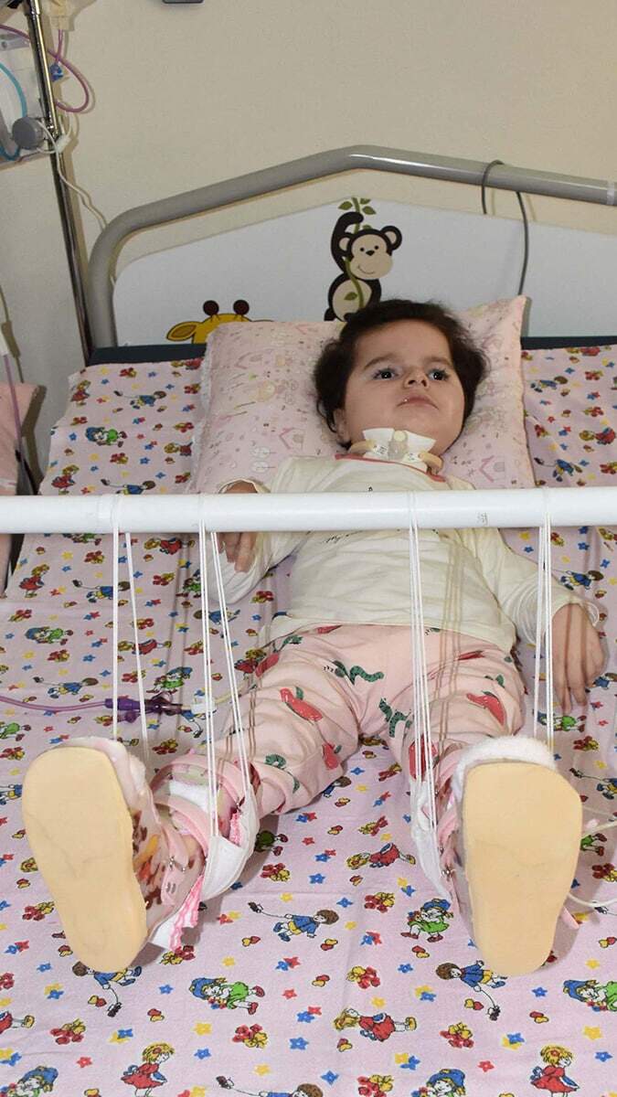 İzmir'in Bornova ilçesinde yaşayan Spinal Müsküler Atrofi (SMA) Tip 1 hastası 4,5 yaşındaki Duru Meriç'in sağlığına kavuşması için zolgensma gen tedavisi olması gerekiyor.