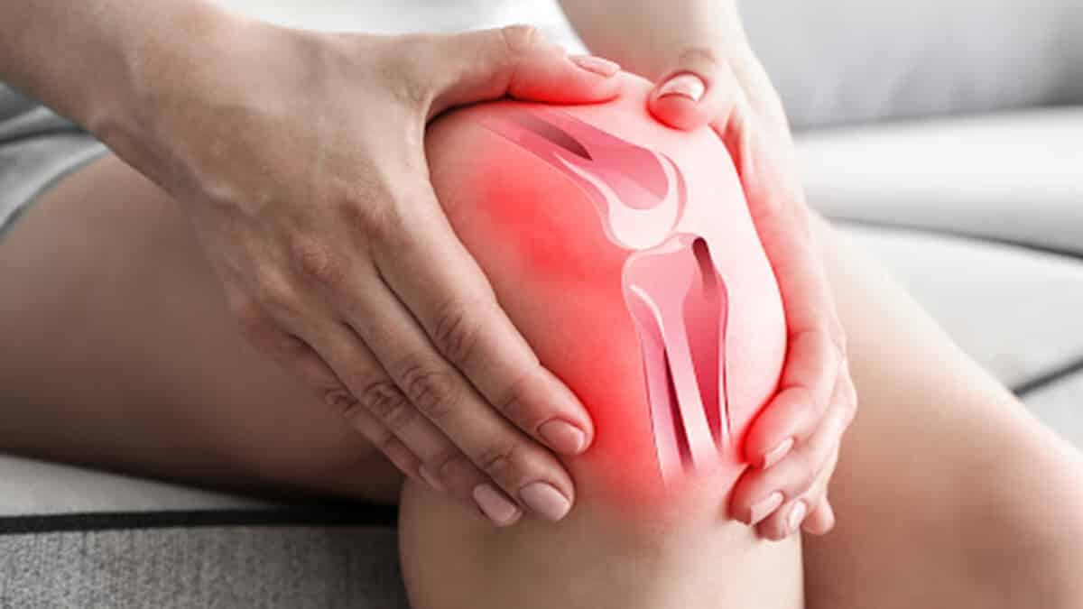 Kireçlenmenin Sinsi Nedeni: Diz Ön Çapraz Bağ Parsiyel Yırtıkları