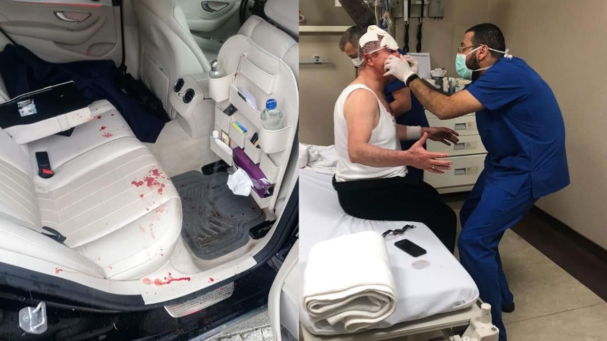 Selçuk Özdağ taburcu oldu, 2 şüpheli gözaltında