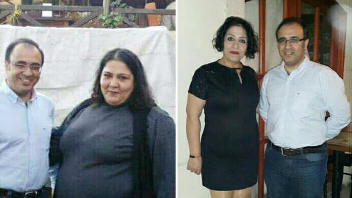 Antalya'da, Anne ve oğlu tüp mide ameliyatıyla 140 kiloya düştü.