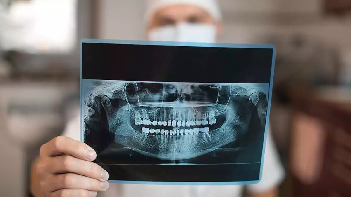 Diş hekimi pertev kökdemir'de dişlerimiz hakkında 5 şaşırtıcı gerçeği paylaştı.