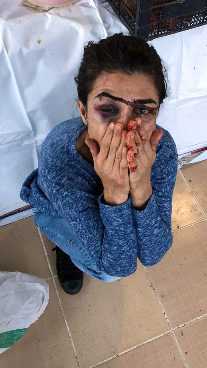 İpek'in avukatları Ahmet Onaran, Hüseyin İlerioğlu ve Nagihan Bulduk da müvekkillerinin evlilikleri boyunca şiddet gördüğünü, olayın yaşanan şiddet nedeniyle meydana geldiğini belirterek, tutuksuz yargılama talep etti.