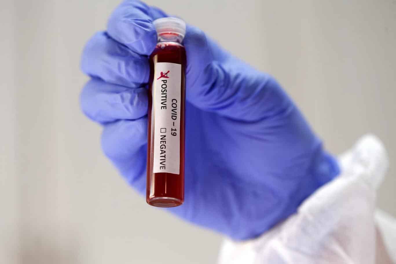 Dünya genelinde can kaybı 1 milyon 860 bin 540