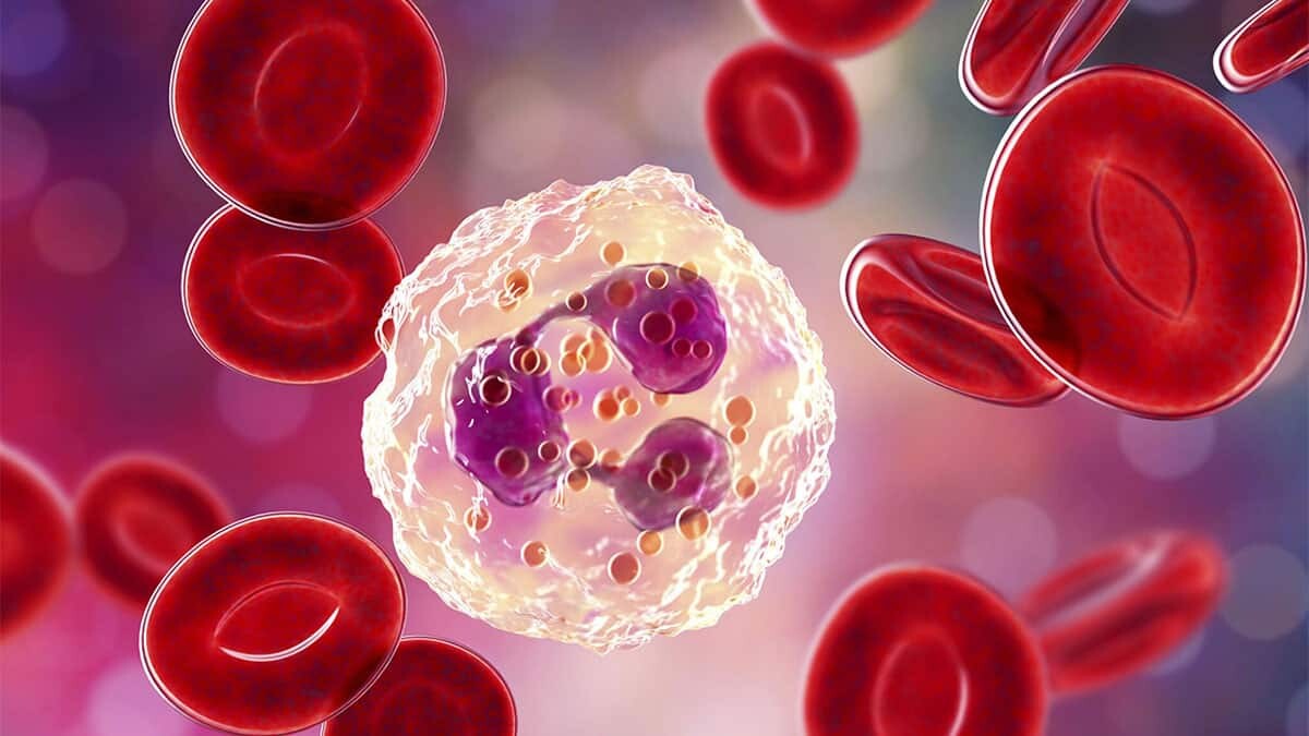 Dikkat bu besinler inflamasyona sebep oluyor