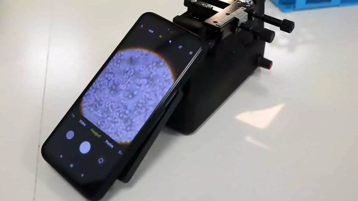 Mobil mikroskop, hayvan ölümlerini durduracak