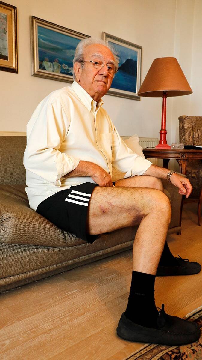 Prof. Dr. Lüleci, 2019 yılında Karaalioğlu Parkı'nda spor yaparken köpeklerin saldırısında bacağından yaralanmıştı.