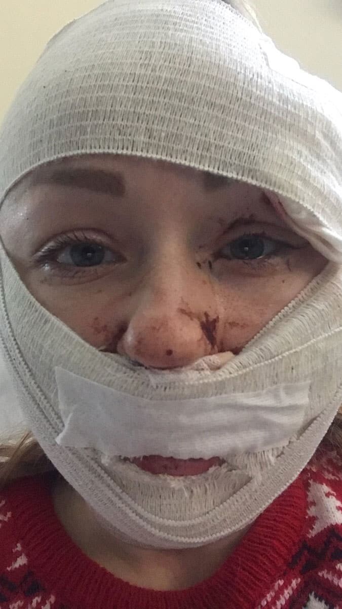 Falçatalı saldırı medyada büyük yankı uyandırdı