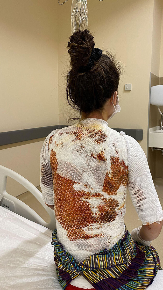 6 yıla kadar hapsi istenen Ali Ay'ın eşi ile kızını haşladığı "sıcak su silah" sayılsın talebi. Eşini tehdit ettiği için 2 yıldan 5 yıla kadar da hapsi istendi.