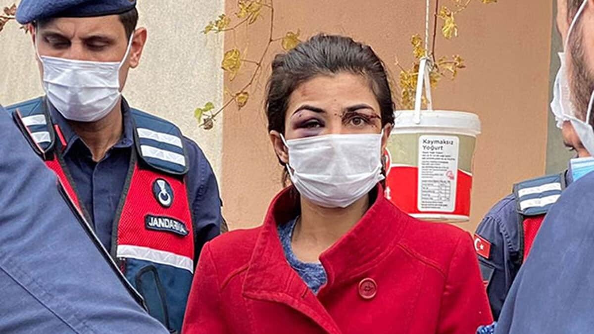 Melek İpek için örselenmiş kadın sendromu raporu