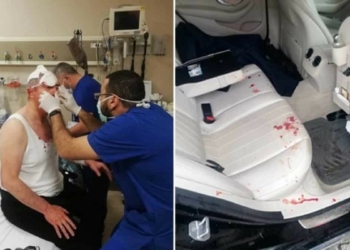 Özdağ'a saldıranlar serbest bırakıldı
