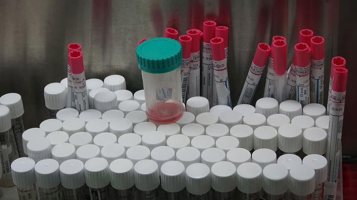 Covid-19 vaka sayılarının nüfusa oranla en yüksek olduğu iller sıralamasında ilk 5 ilin yer aldığı Karadeniz mutasyonuna genetik takip yapılmalı önerisi.