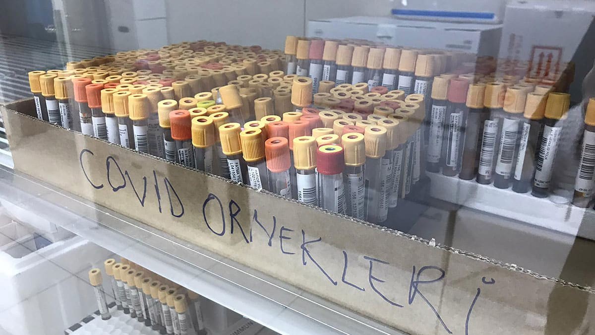 Alınan tedbir ve kısıtlamalara rağmen, Karadeniz’deki vakalarda beklenen düşüşün yaşanmaması üzerine bilim insanları harekete geçti.