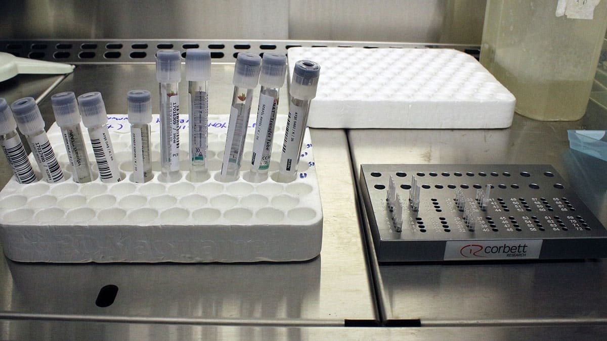 İngiltere'den gelen mutant etkisini gösteriyor