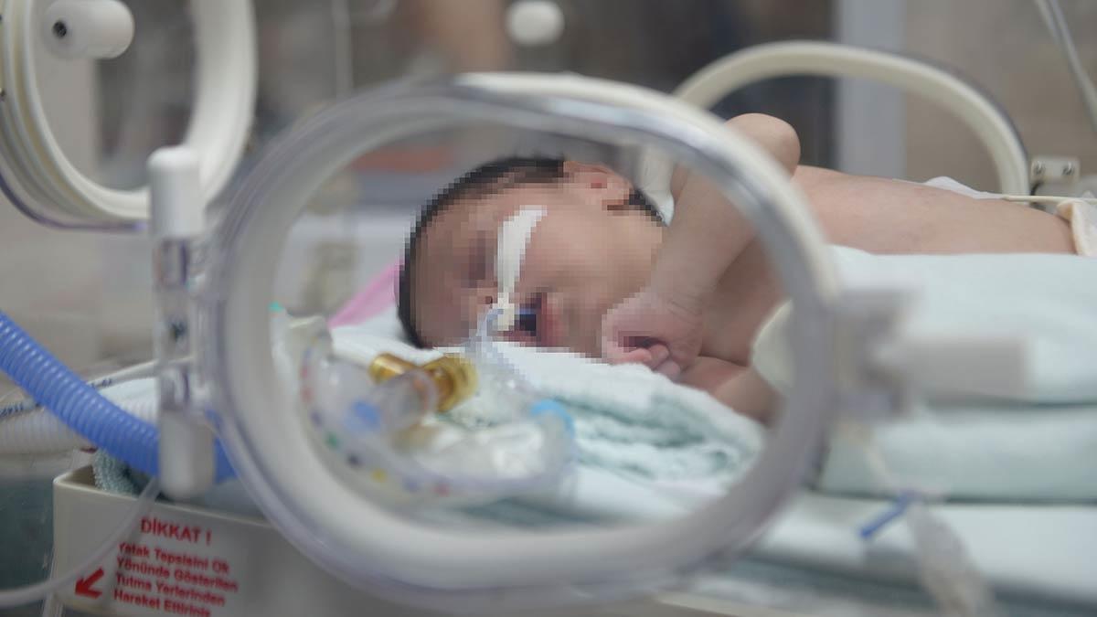 Prof. Dr. Nejat Narlı, koronavirüslü annelerin dünyaya getirdikleri bebeklerin büyük oranda tedaviye ihtiyaç olmadan taburcu edildiğini fakat erken doğum riskinin fazla olduğunu belirtti.