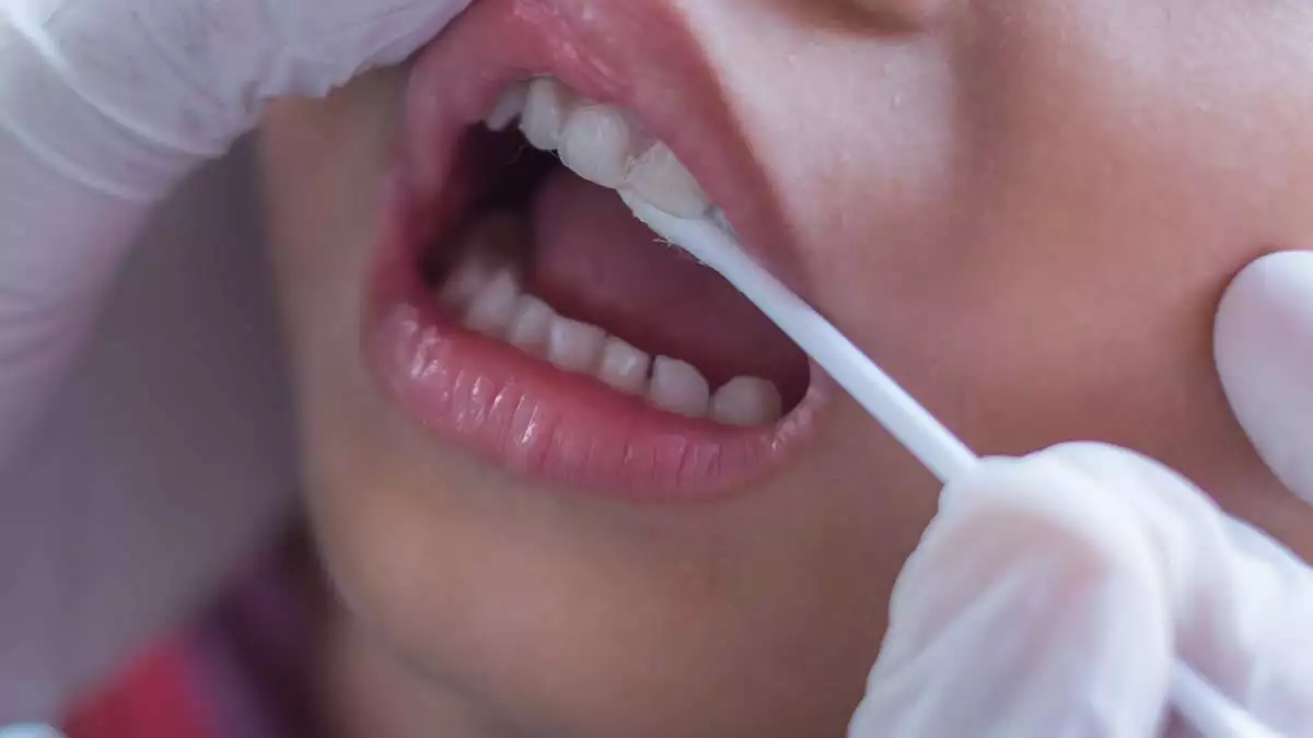 Çocuklarda diş çürükleri neden kaynaklanıyor