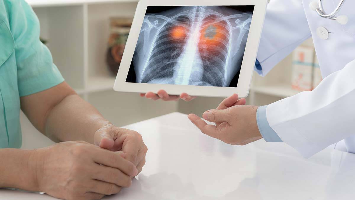 Akciğer kanserinde tarama yaşı düştü