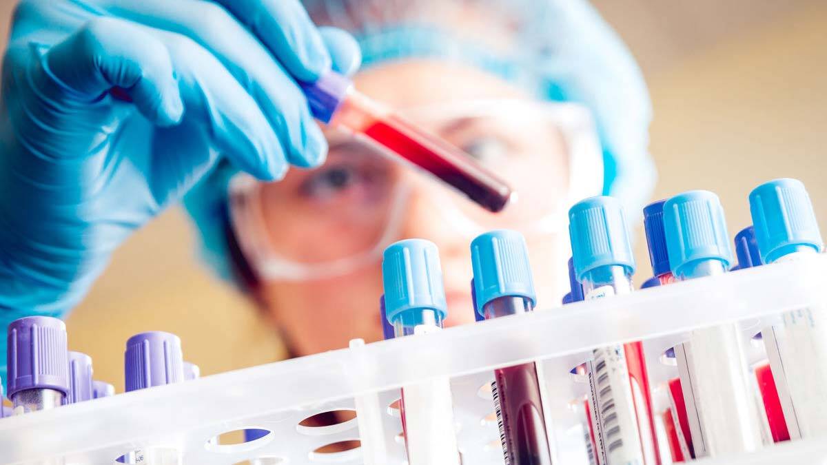 Kronik lösemiler yavaş çoğalan lösemilerdir