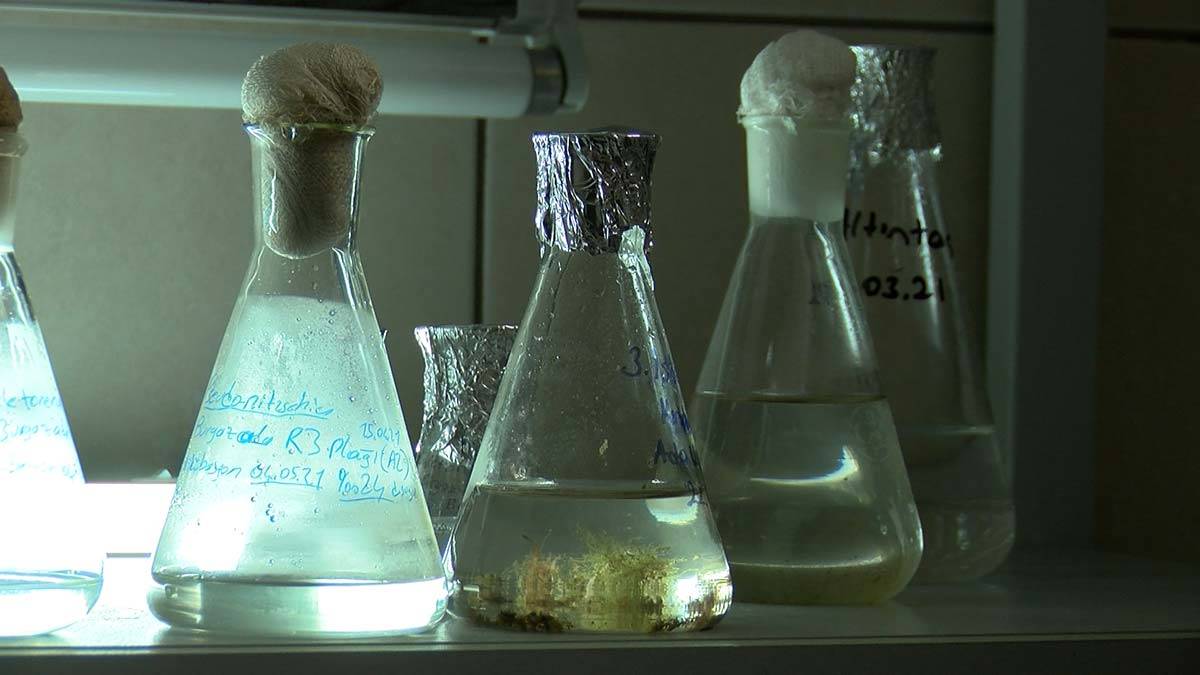 Dipteki bakteriler tarafından bunlar ayrıştırılamaya başladığı zaman, bakteriler oksijen tüketerek bunları ayrıştıracak. Bunlarında oksijeni tüketmesiyle birlikte ortamı anoksik yaptığı bir durum oluşacak. Bundan sonrasında dip ölümü bekliyoruz