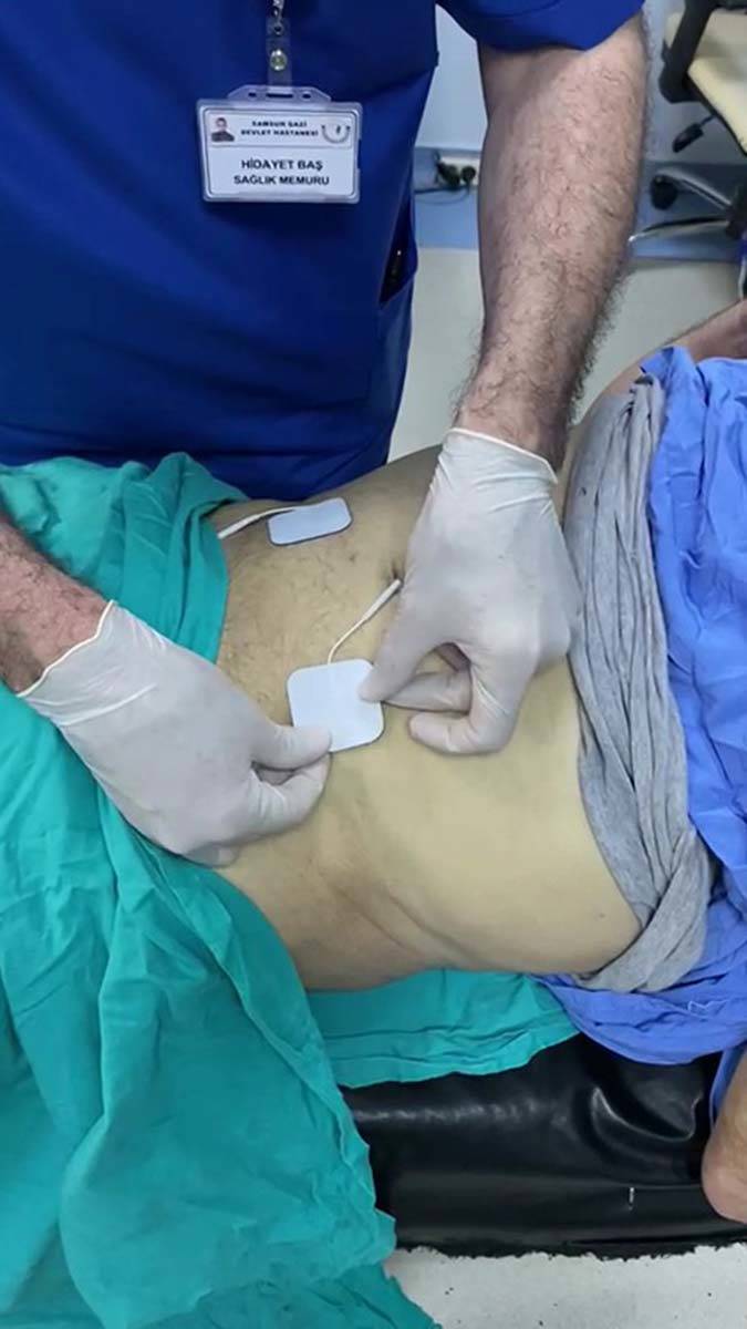 Ağrısız prostat biyopsi tekniği tıp literatüründe