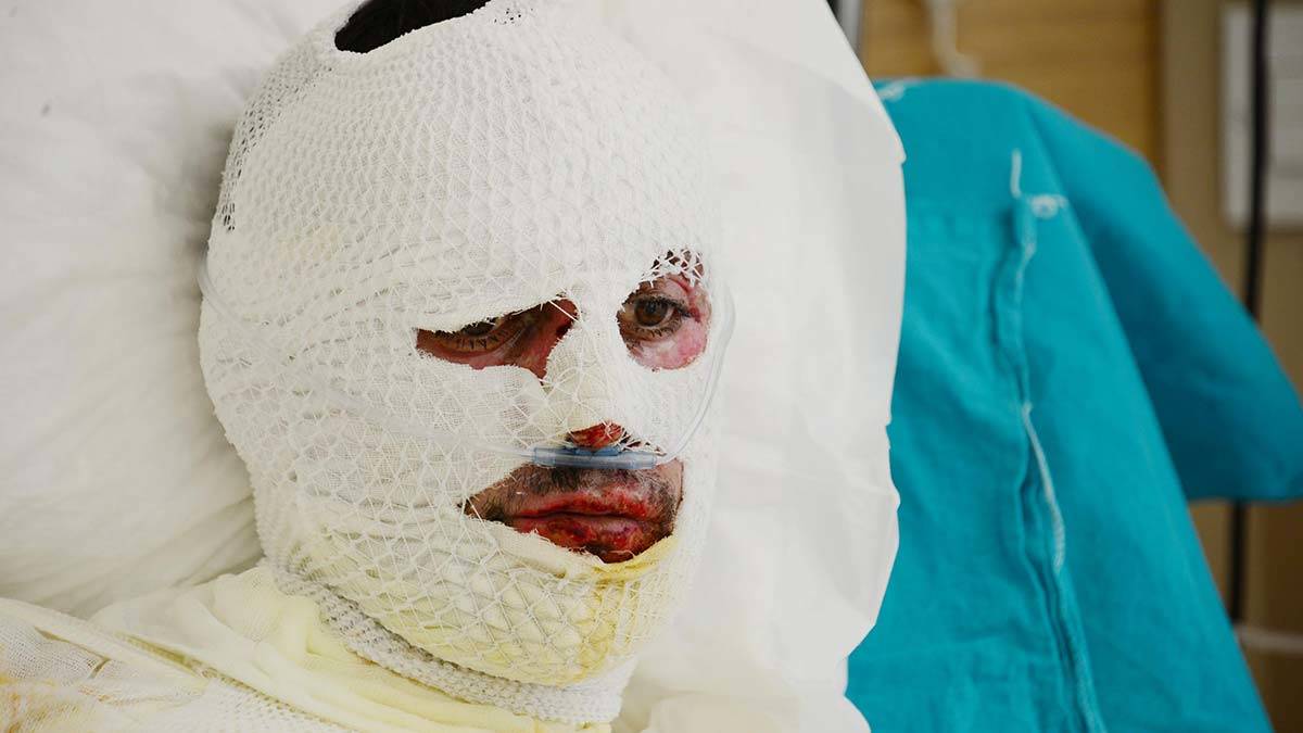 Üzerine yıldırım düşen çoban ağır yaralandı