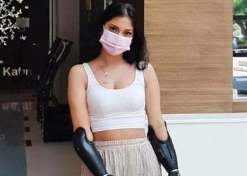 Çift Kol Nakli İçin Antalya'ya Gelen 24 Yaşındaki Beyza Doğan Bekleme Sırasına Kaydoldu