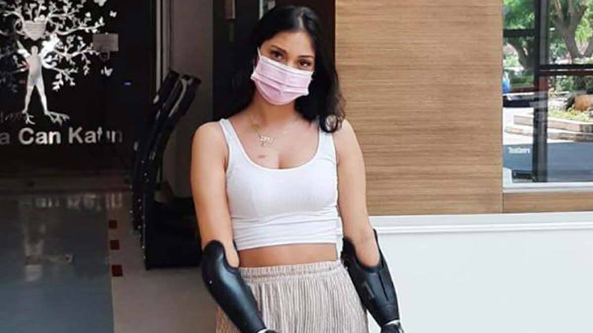 Çift Kol Nakli İçin Antalya'ya Gelen 24 Yaşındaki Beyza Doğan Bekleme Sırasına Kaydoldu