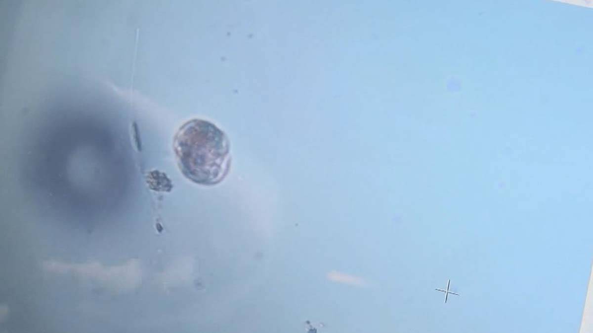 İÜ'de müsilaj incelemesinin ilk sonuçları