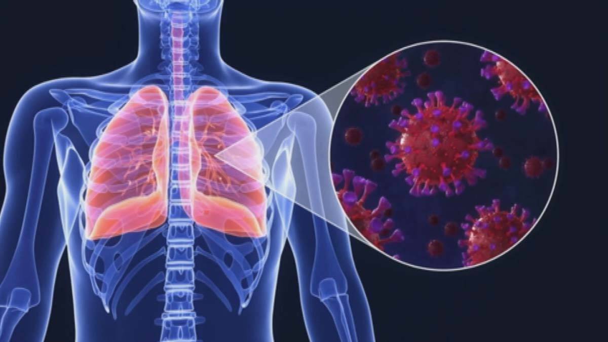 Yapay zeka ile birkaç saniyede kovid teşhisi