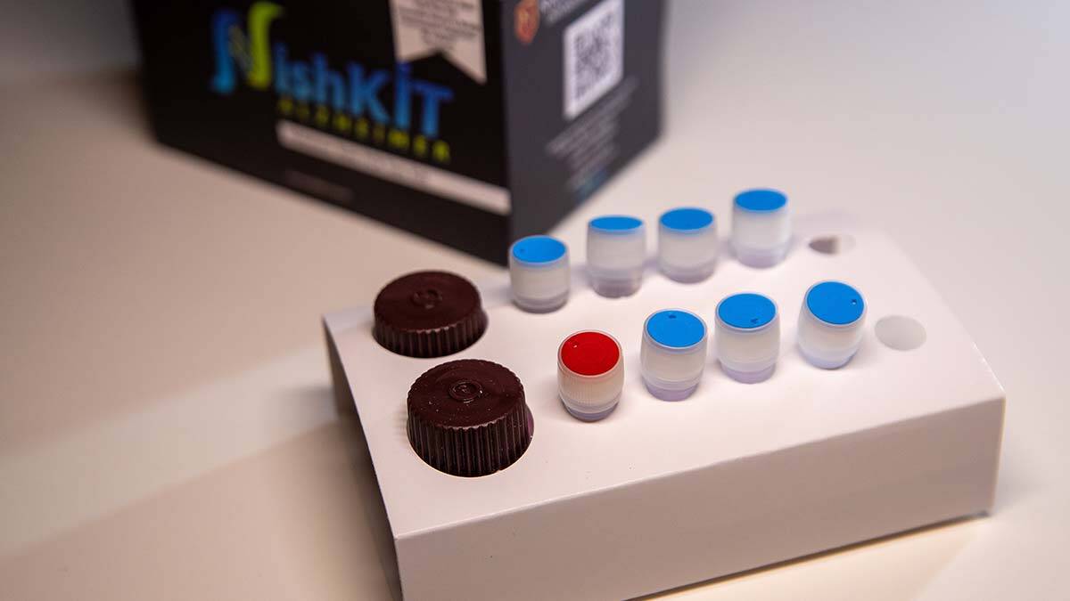 Alzheimer riskini ölçen tanı kiti geliştirildi